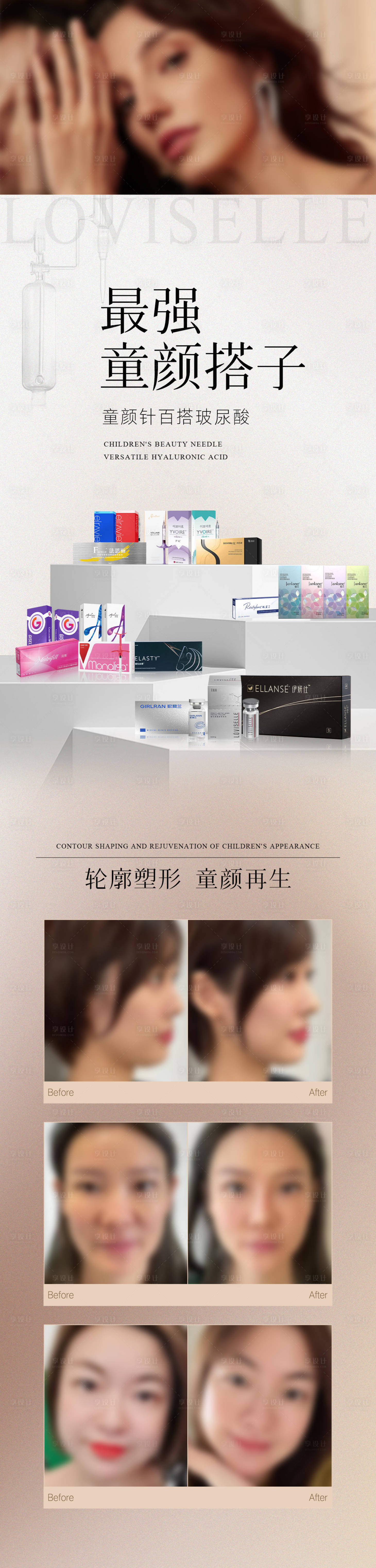 源文件下载【享设计】搜索编号：71890022084824814【童颜针玻尿酸案例长图】