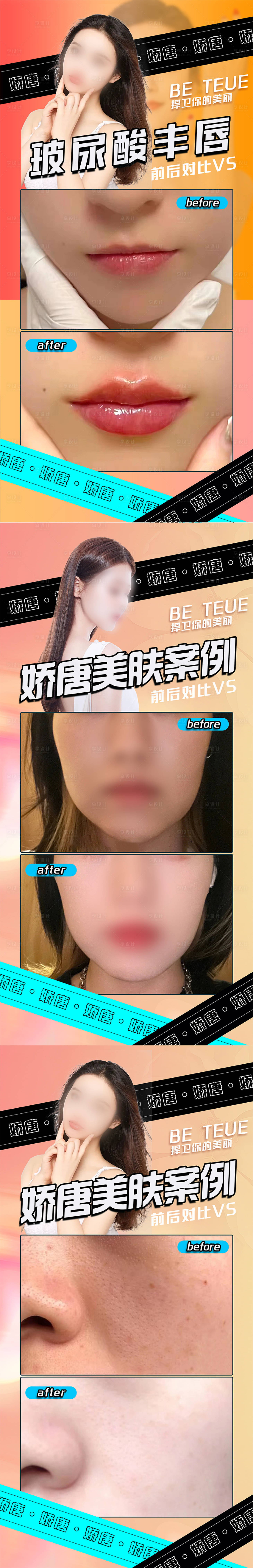 源文件下载【享设计】搜索编号：54590022078564709【医美案例对比】