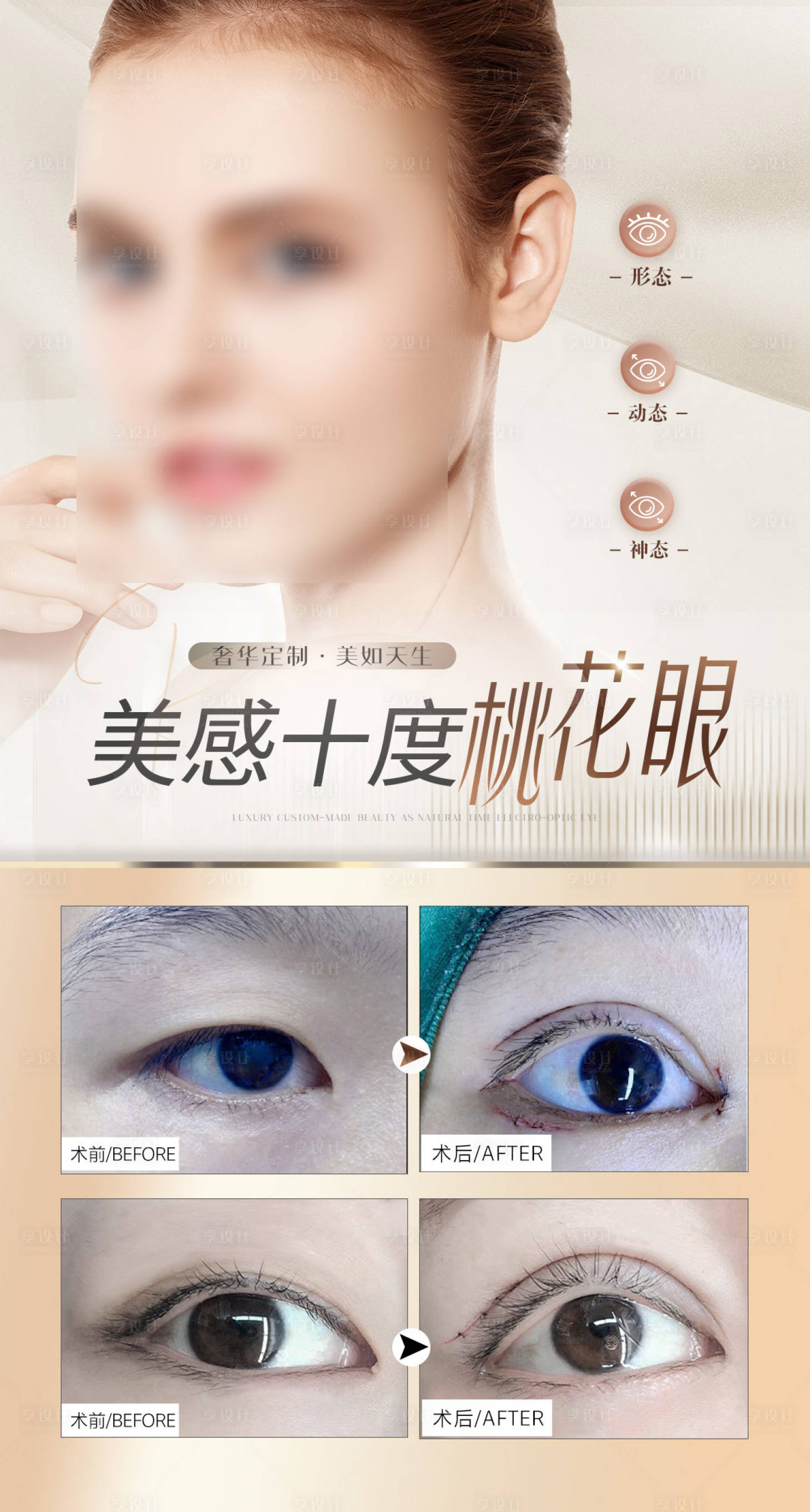 源文件下載【享設(shè)計(jì)】搜索編號：74900022130595147【雙眼皮】