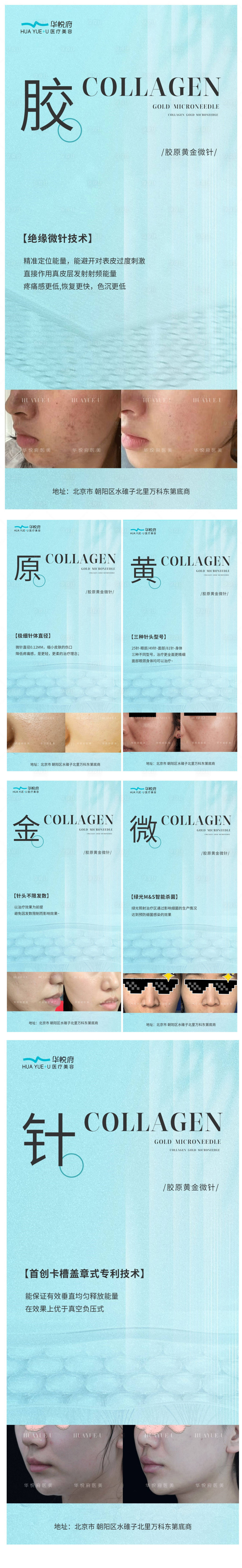 源文件下载【享设计】搜索编号：26330021916089527【黄金微针核心优势海报】