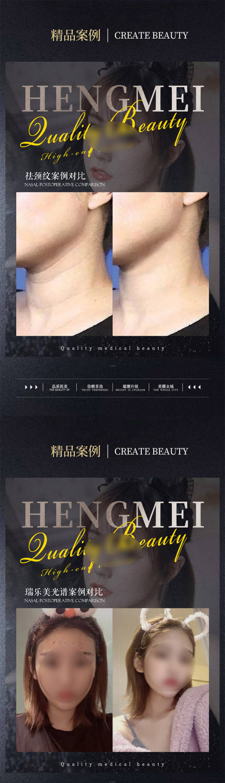 源文件下載【醫美整形案例對比系列海報】編號：81760022067451175