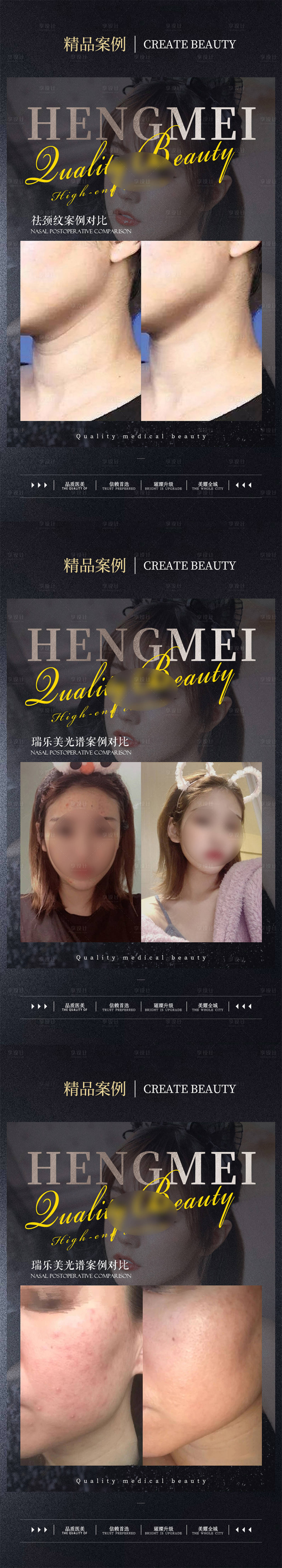 源文件下载【医美整形案例对比系列海报】编号：81760022067451175
