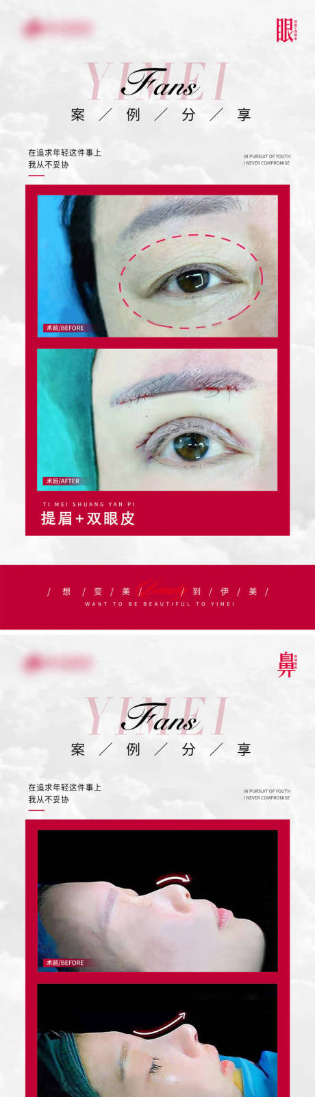 源文件下载【医美案例对比模版】编号：91700022115217234