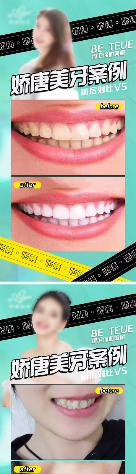 编号：71380022078298578【享设计】源文件下载-医美牙齿美容案例对比