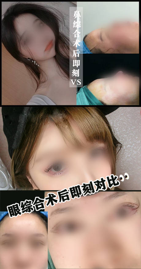 源文件下载【享设计】搜索编号：27640022072277745【医美案例对比海报】