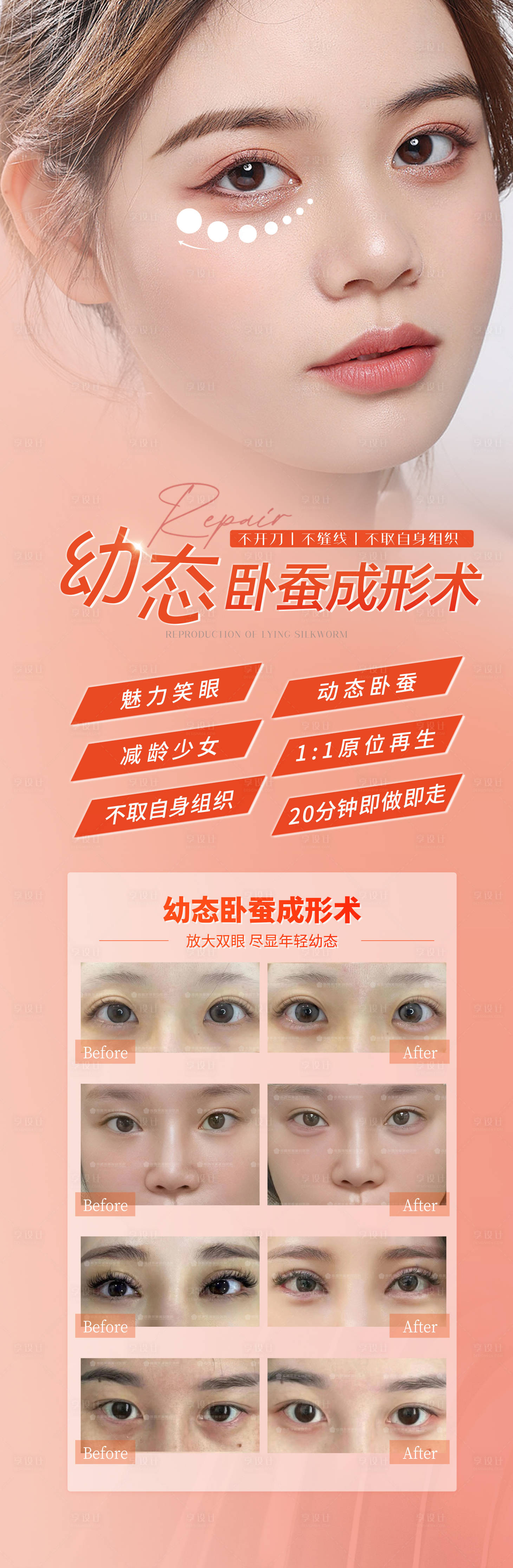 源文件下載【享設(shè)計(jì)】搜索編號：20940021963518187【幼態(tài)臥蠶再造術(shù)案例海報(bào)】