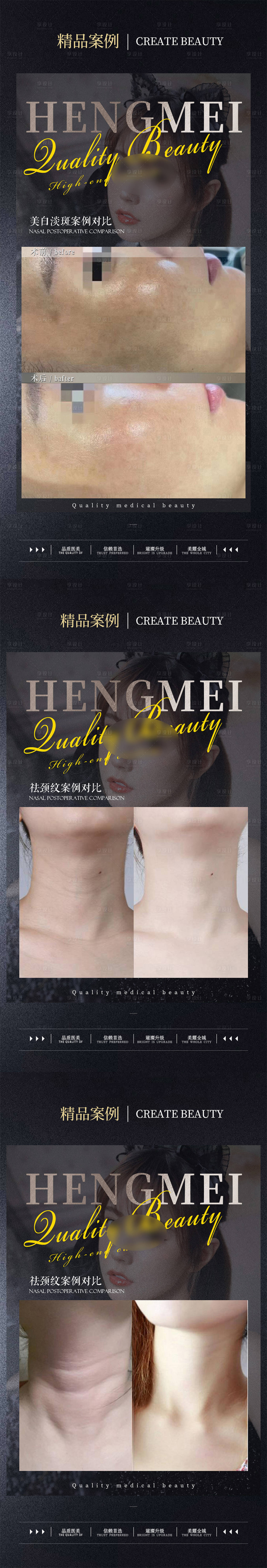 源文件下載【醫美海報】編號：28960022067426284