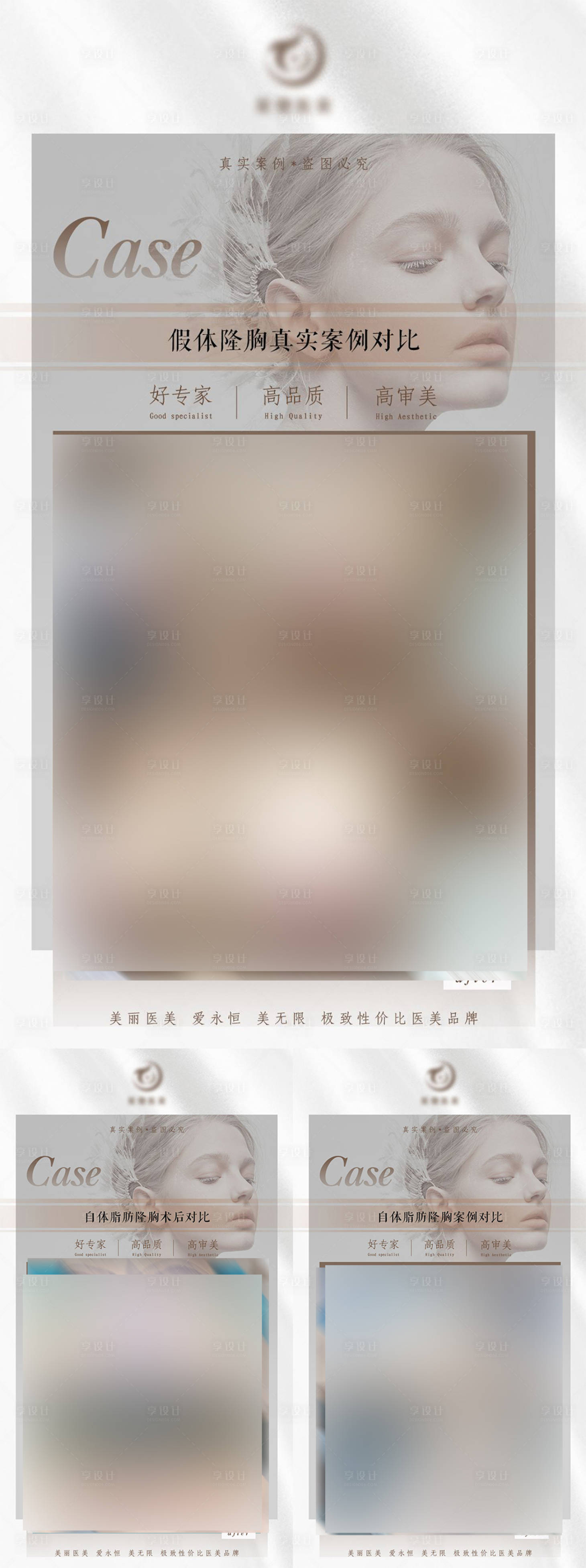 源文件下載【享設計】搜索編號：44060012561272697【醫美案例對比】