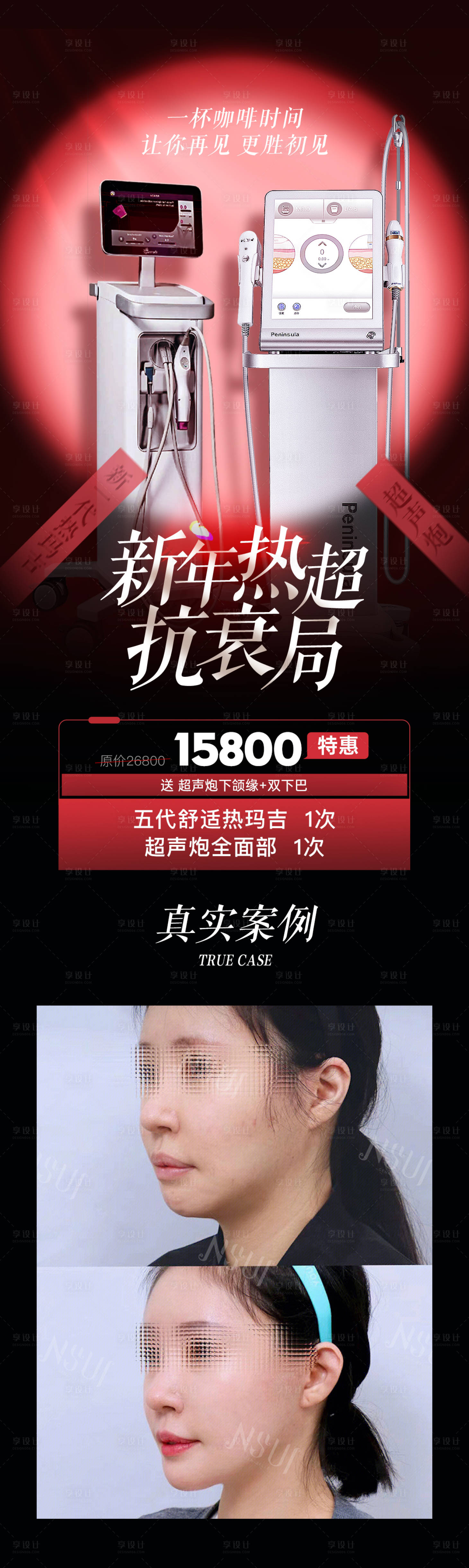源文件下载【医美热玛吉超声炮抗衰海报】编号：29550022106471361
