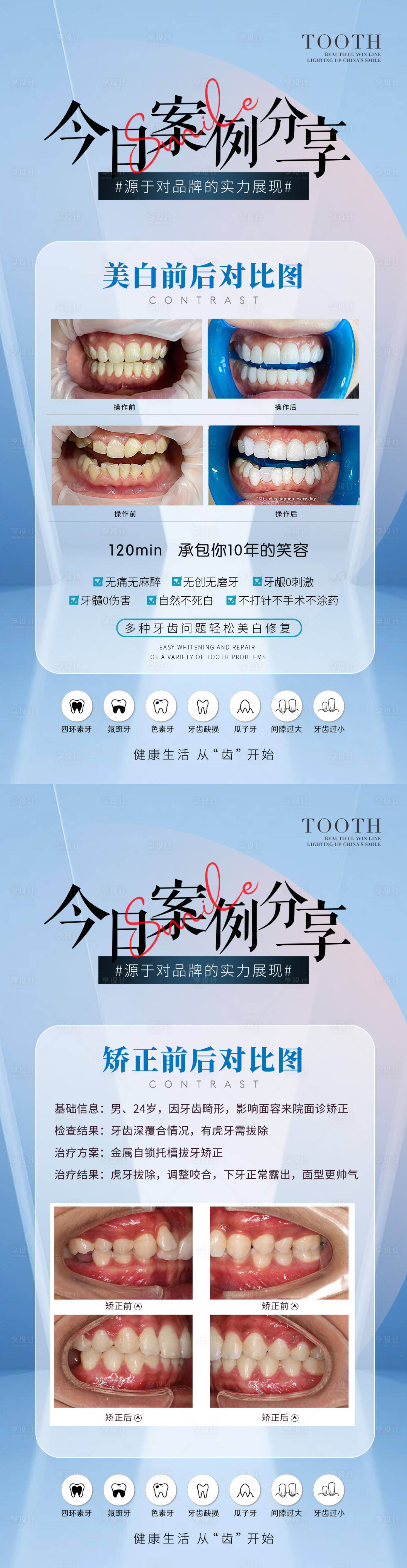 源文件下載【享設計】搜索編號：16080021890036400【醫療牙齒美白矯正案例】
