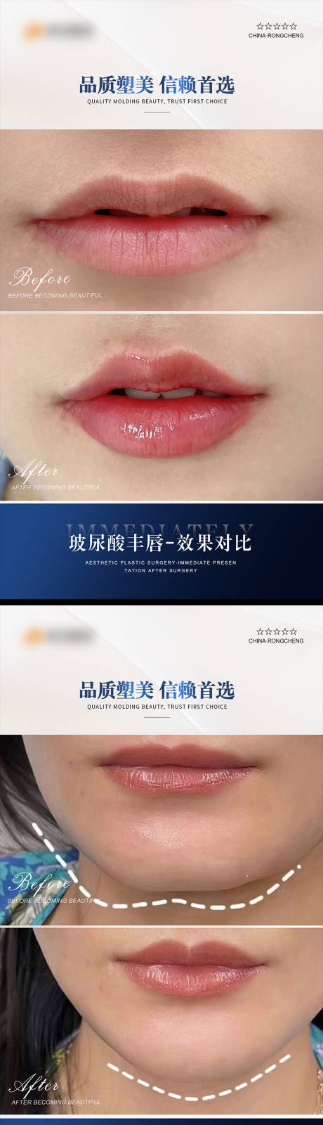 源文件下载【医美案例对比海报】编号：48130021963912143