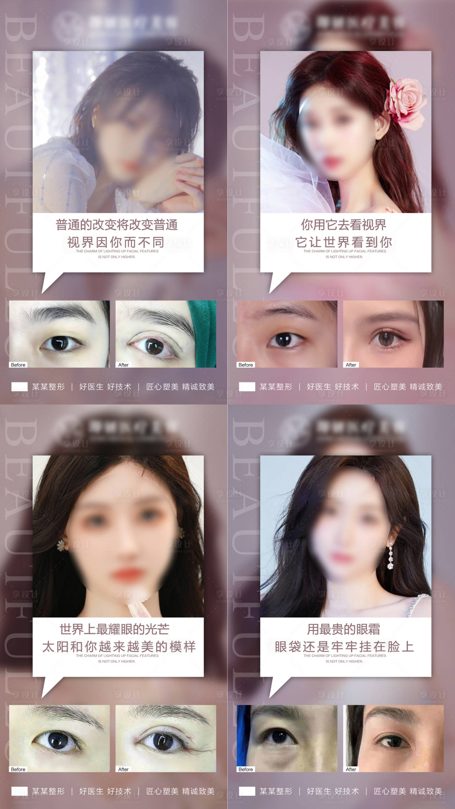 源文件下载【医美案例眼综合眼睛双眼皮】编号：75430022076832054