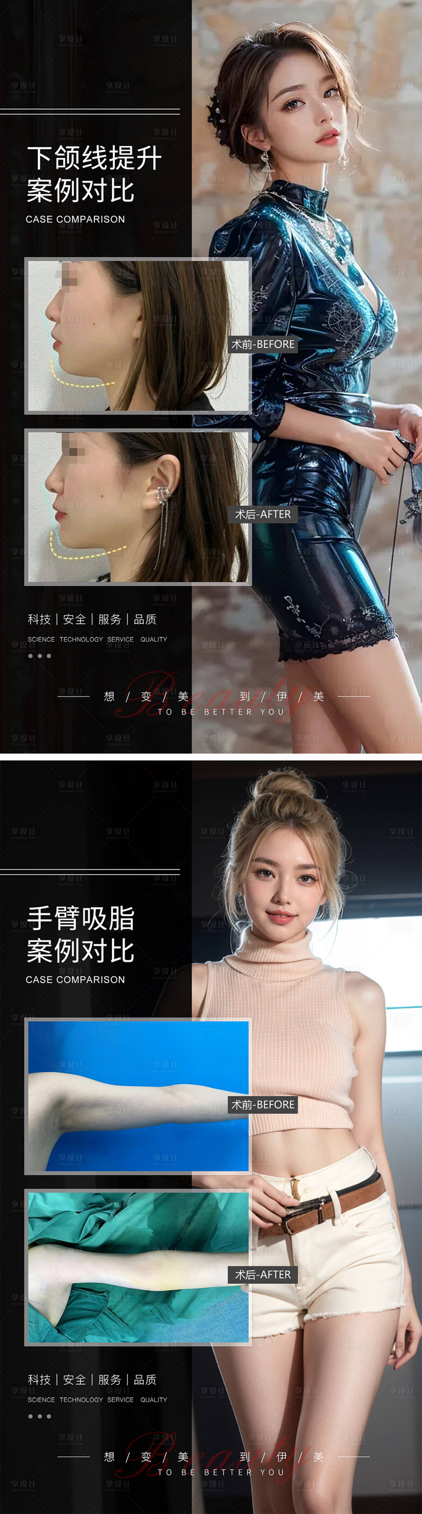 源文件下载【享设计】搜索编号：85830022067483986【医美案例对比模版海报】