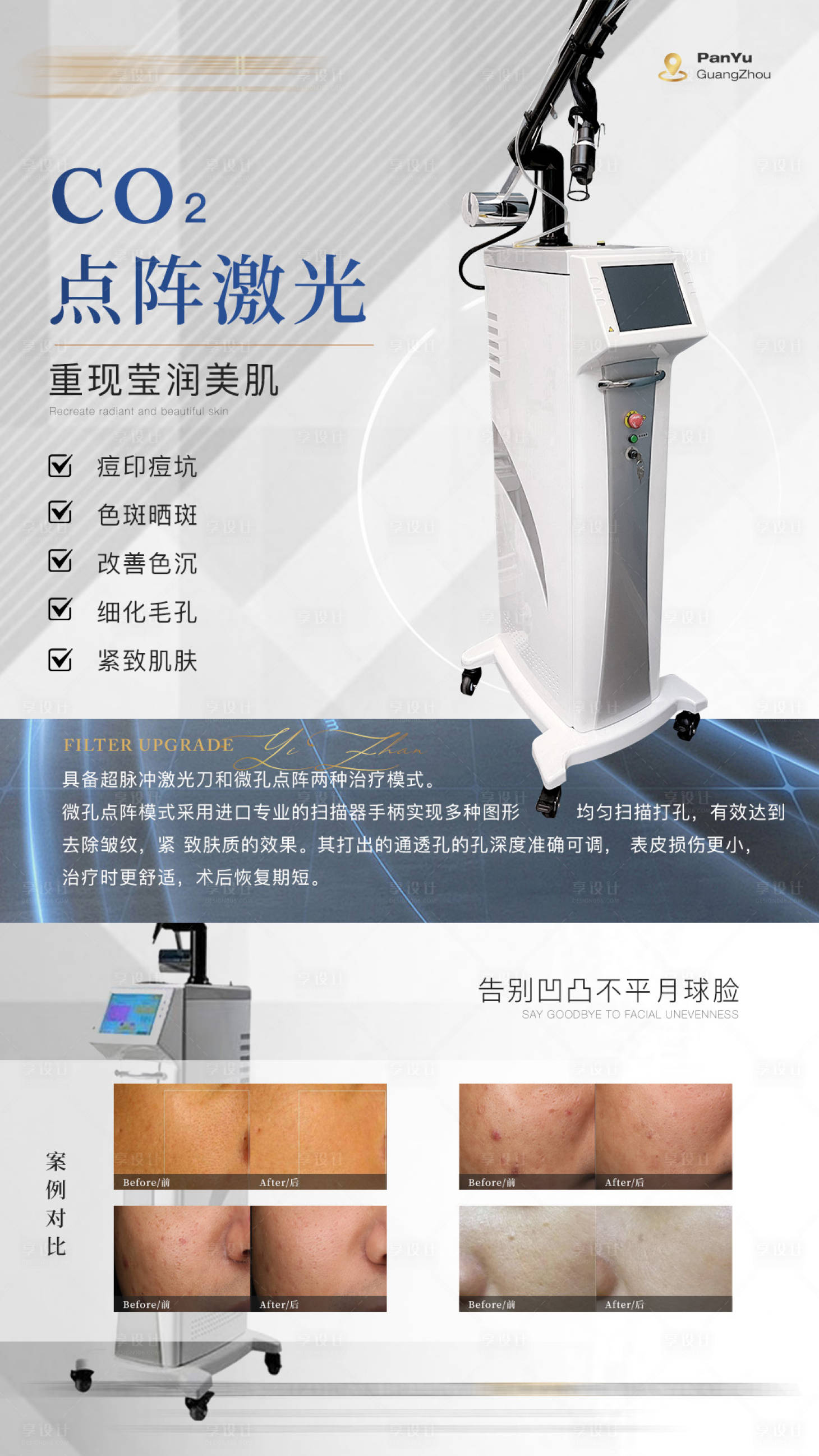 源文件下载【二氧化碳点阵激光医美仪器科普海报】编号：58300022517317925