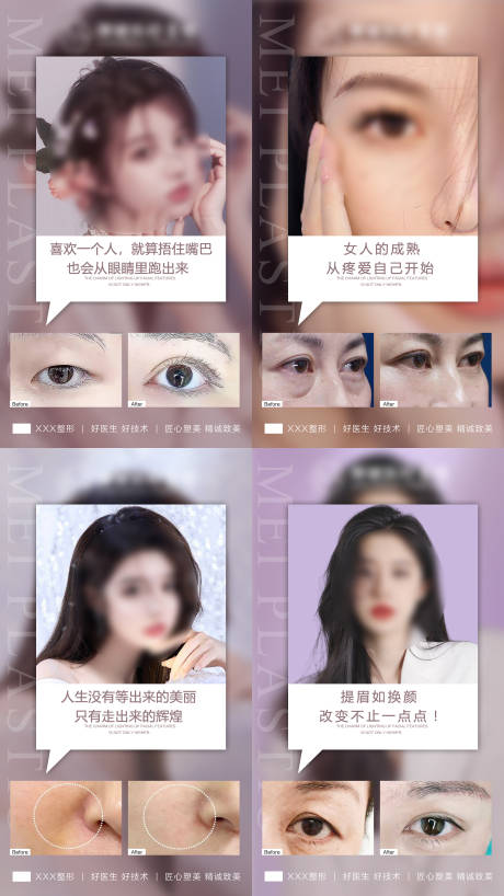 源文件下载【医美案例系列海报】编号：85910022355345821