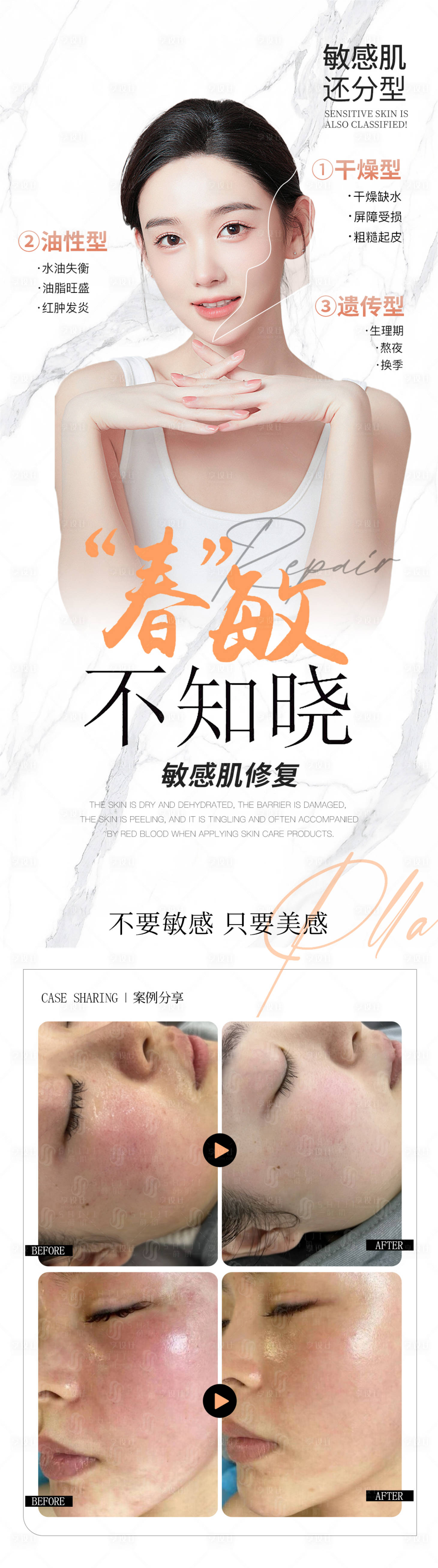 源文件下载【医美敏感肌案例海报】编号：75870022650278185