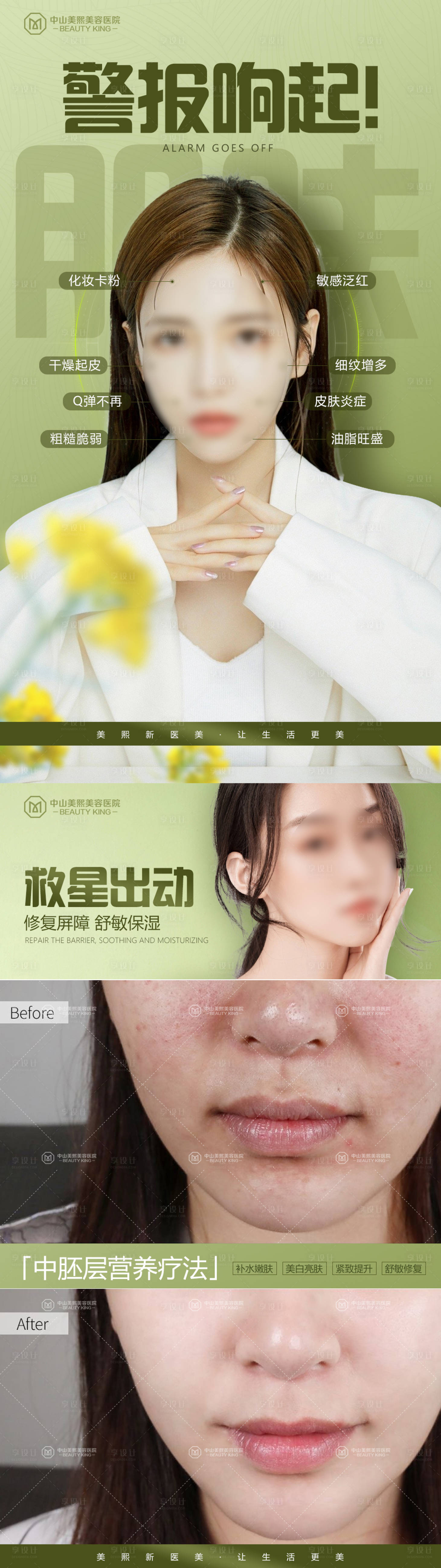 源文件下载【换季肌肤警报响起】编号：48220022449672913