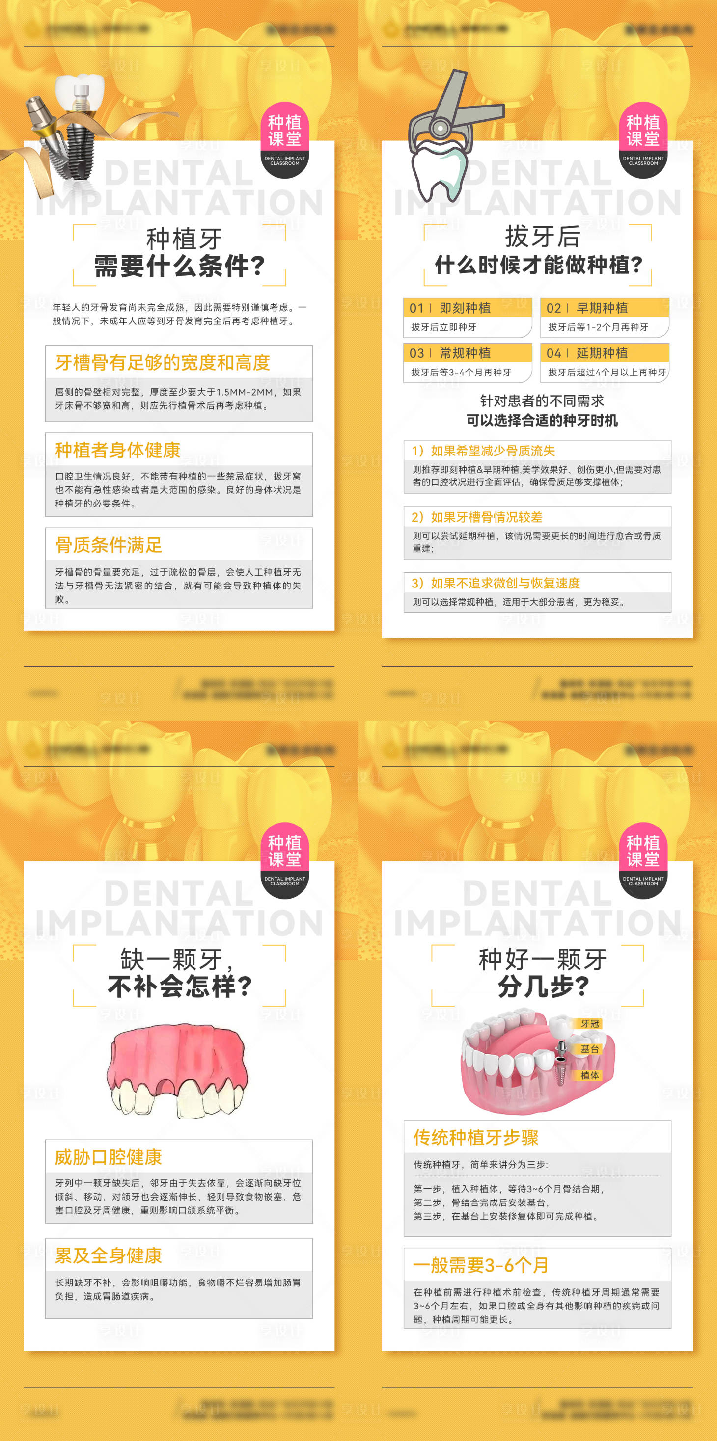 源文件下載【享設(shè)計】搜索編號：42220022506241909【種植牙科普海報】