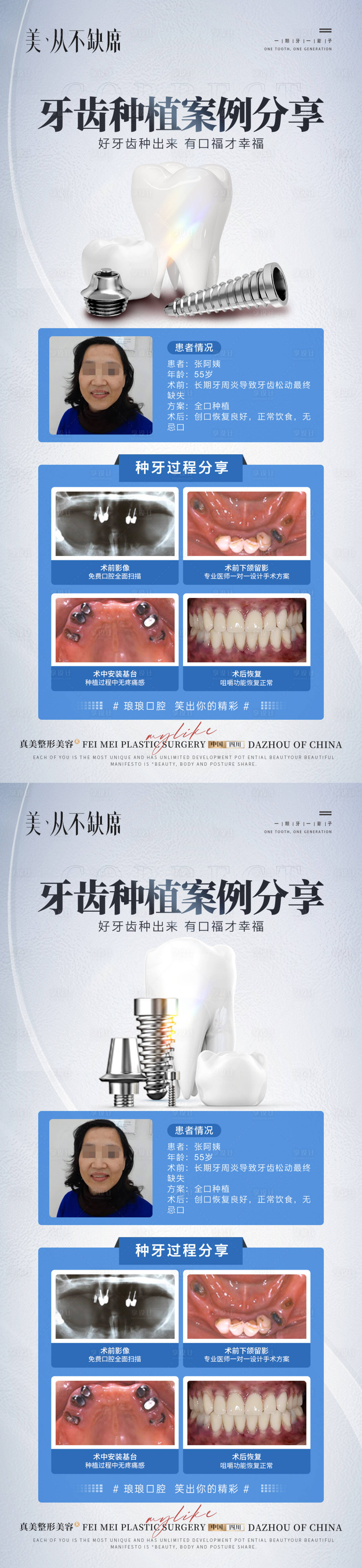 源文件下載【享設計】搜索編號：15430022781796623【醫(yī)美口腔種植案例海報】