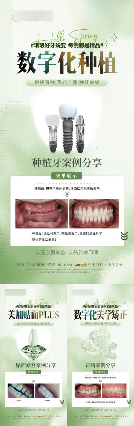 口腔种植贴面矫正案例海报-源文件【享设计】