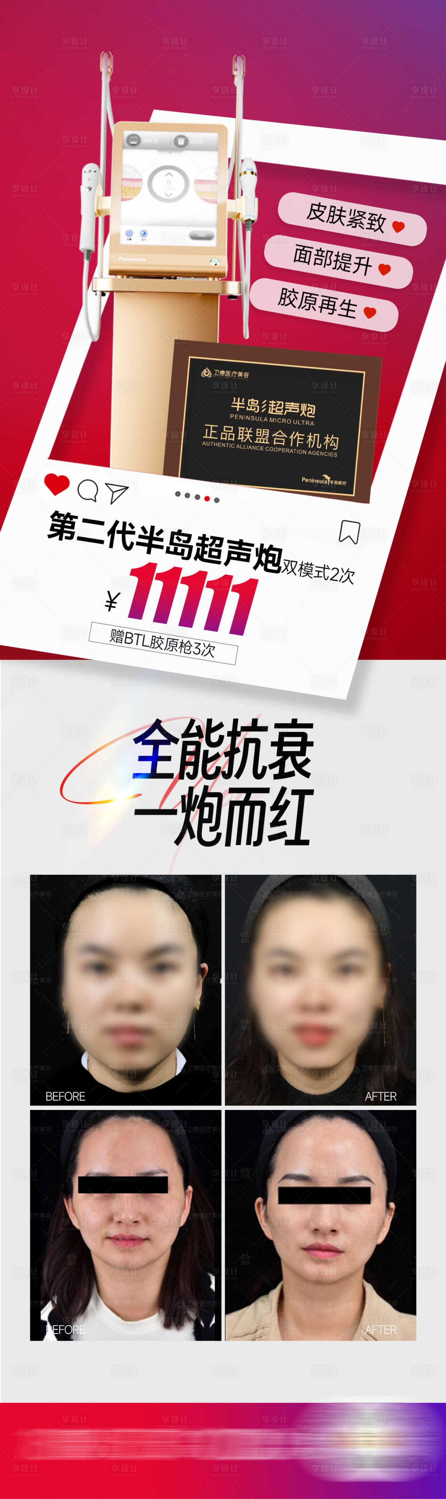 源文件下载【享设计】搜索编号：92480022800254029【黄金超声炮长图海报】