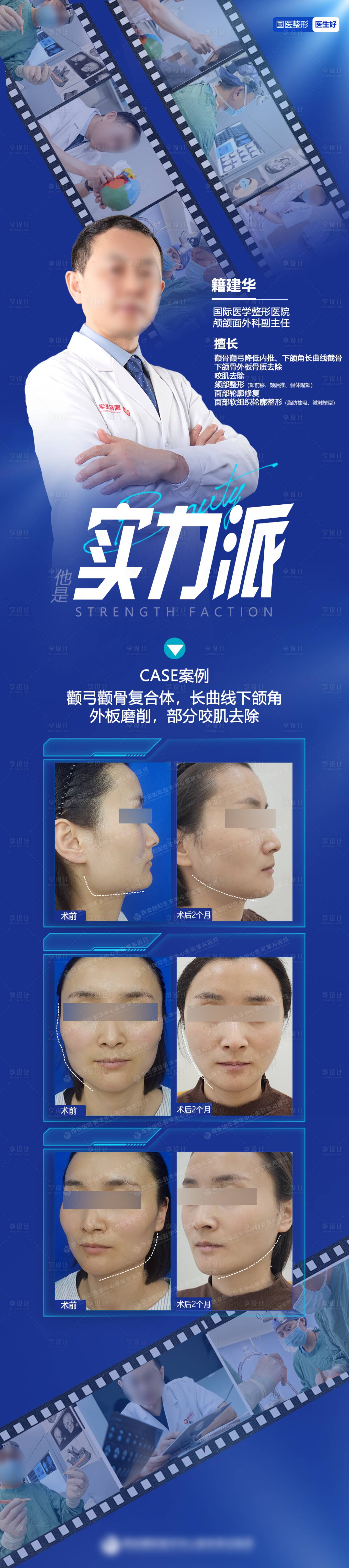 源文件下載【享設(shè)計】搜索編號：16670022492727767【醫(yī)美頜面案例長圖】