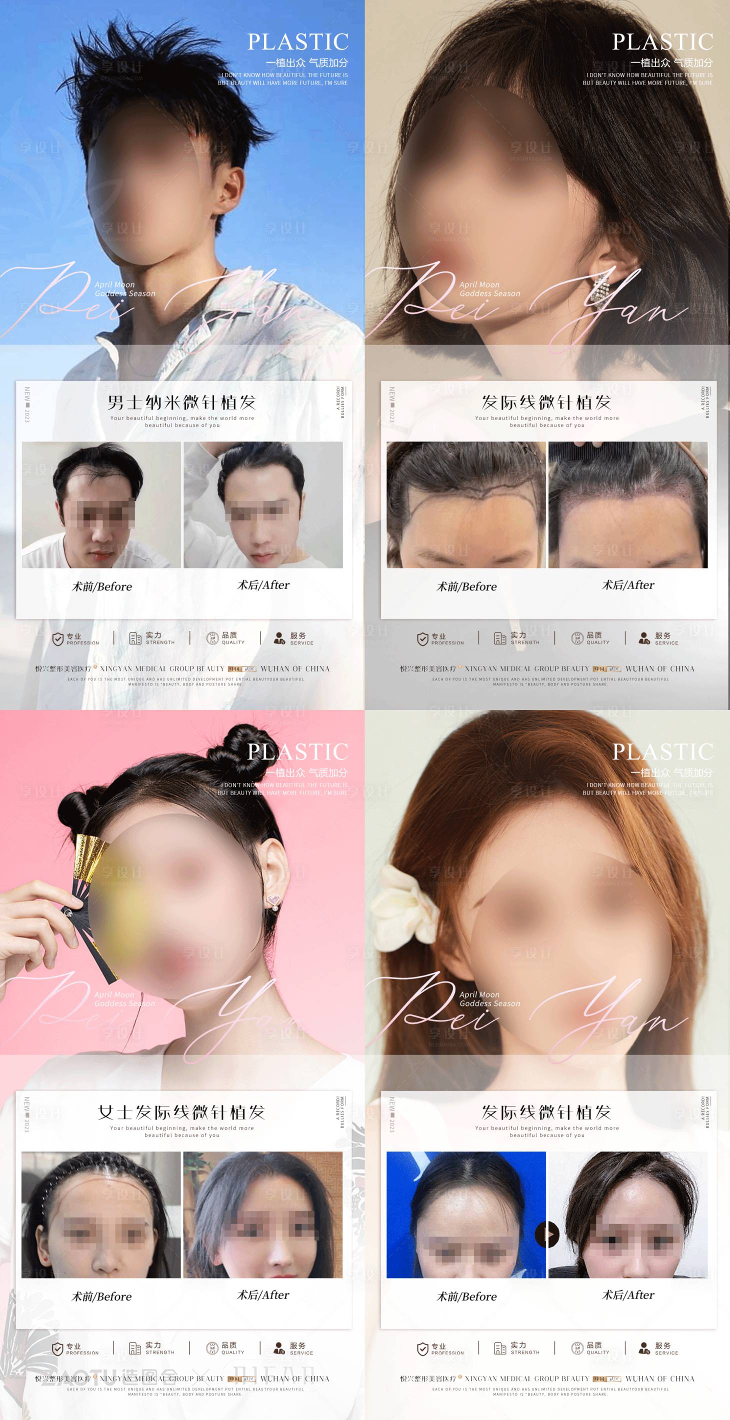 源文件下載【享設計】搜索編號：53590022360482596【植發(fā)案例海報】