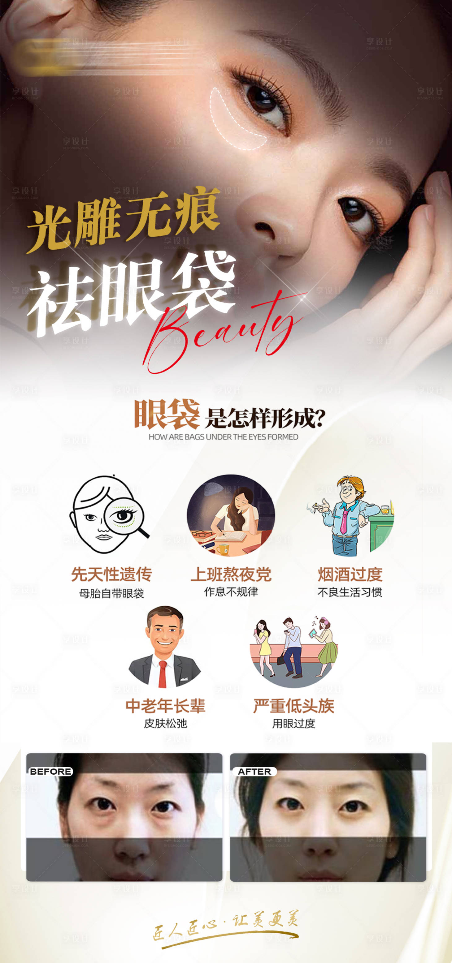 源文件下载【享设计】搜索编号：22270022734937887【祛眼袋医美海报】
