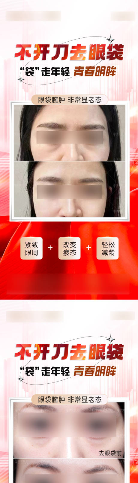 源文件下载【享设计】搜索编号：93330022797754491【祛眼袋海报】