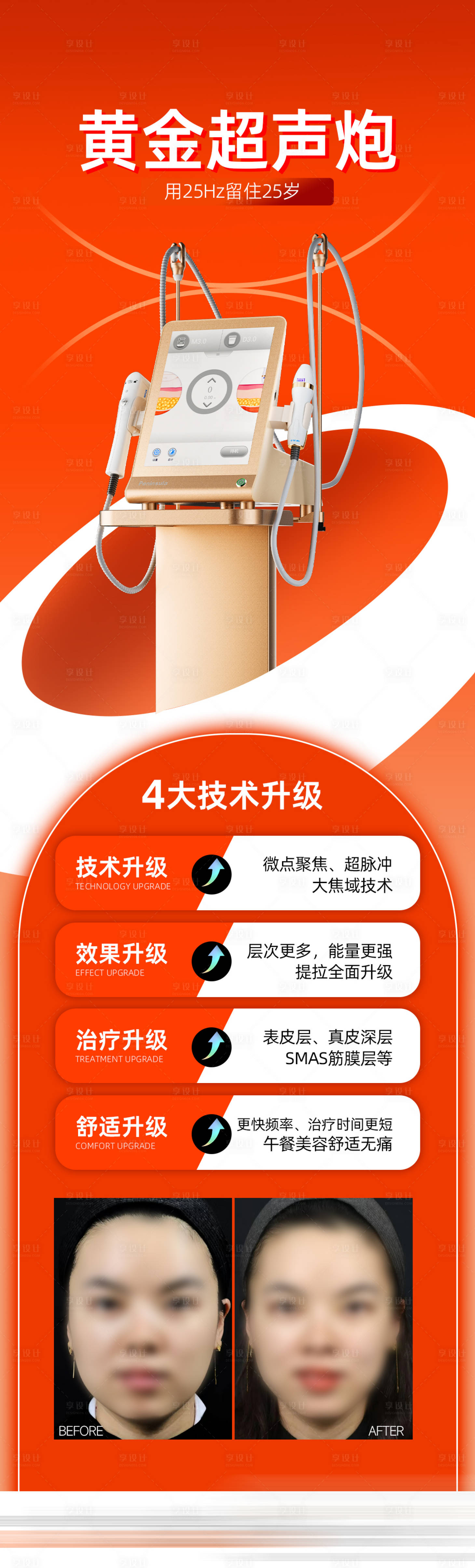 源文件下載【享設計】搜索編號：10710022800739114【黃金超聲炮案例長圖海報】