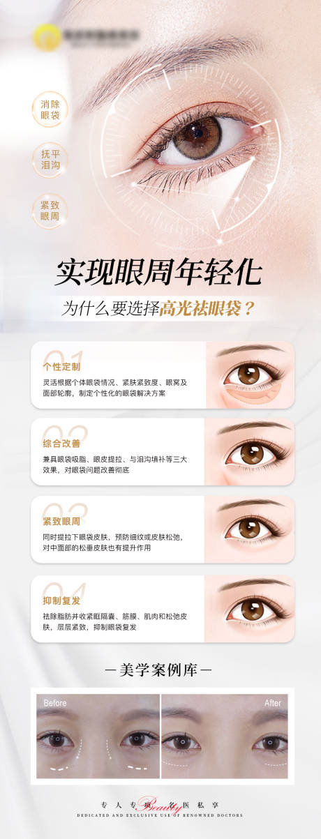 源文件下载【享设计】搜索编号：71740022505076284【祛眼袋海报】