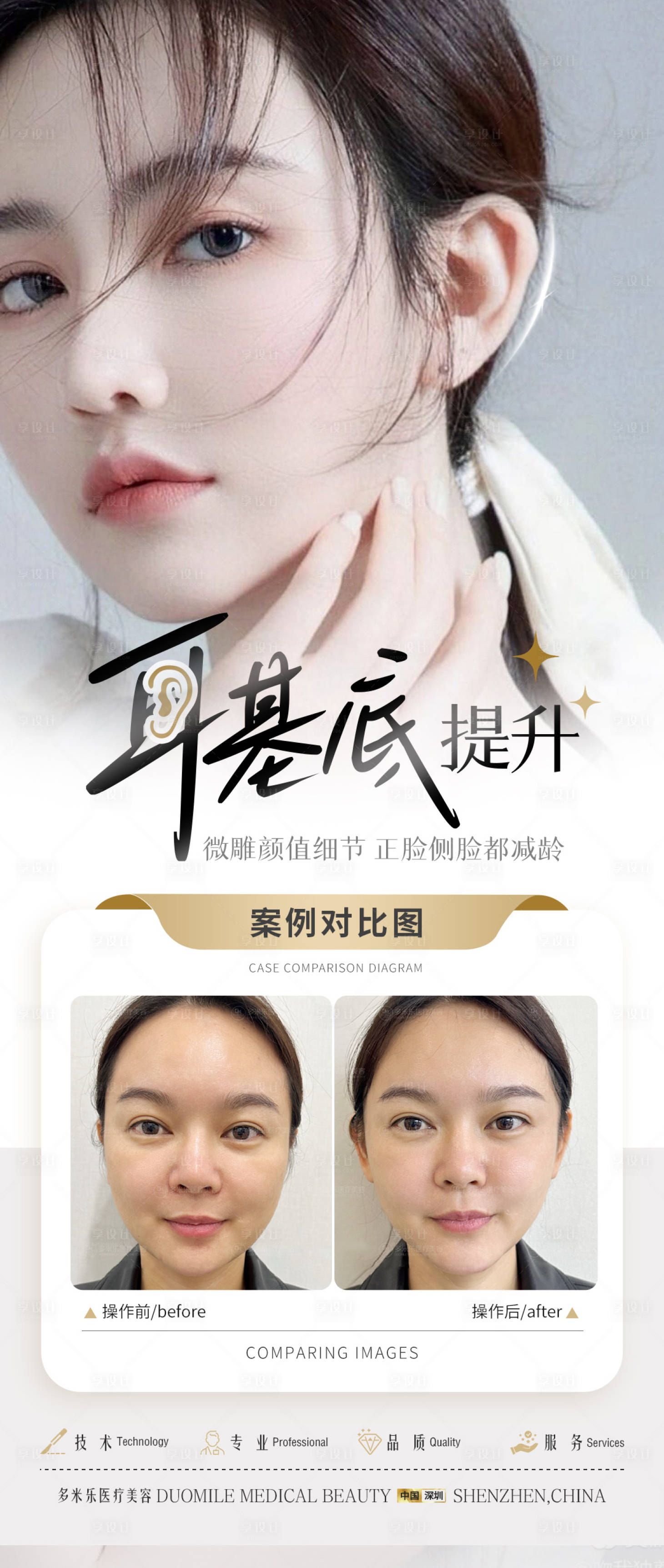 源文件下载【享设计】搜索编号：83050022847158964【医美整形高清案例分享系列海报 】