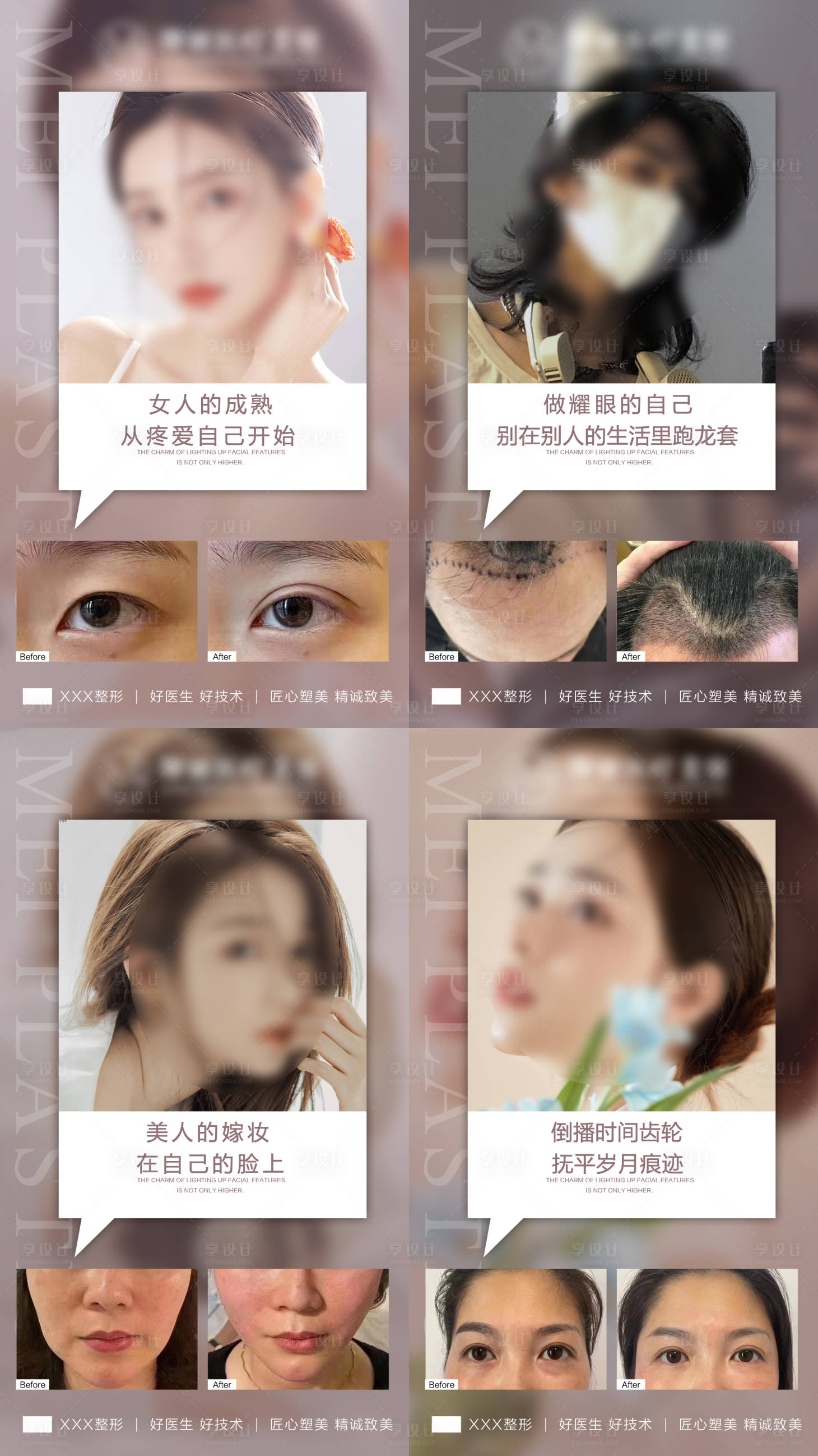 源文件下載【享設計】搜索編號：73360022480782428【醫美案例宣傳海報展板】