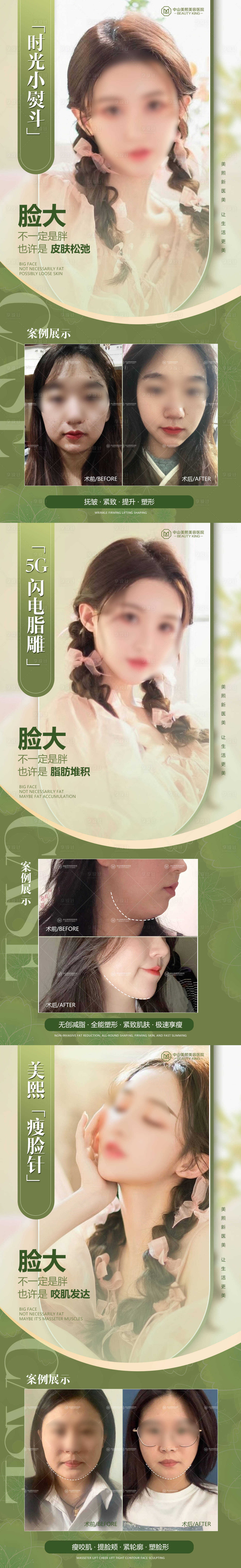 源文件下載【享設計】搜索編號：53980022449634182【瘦臉案例系列海報】