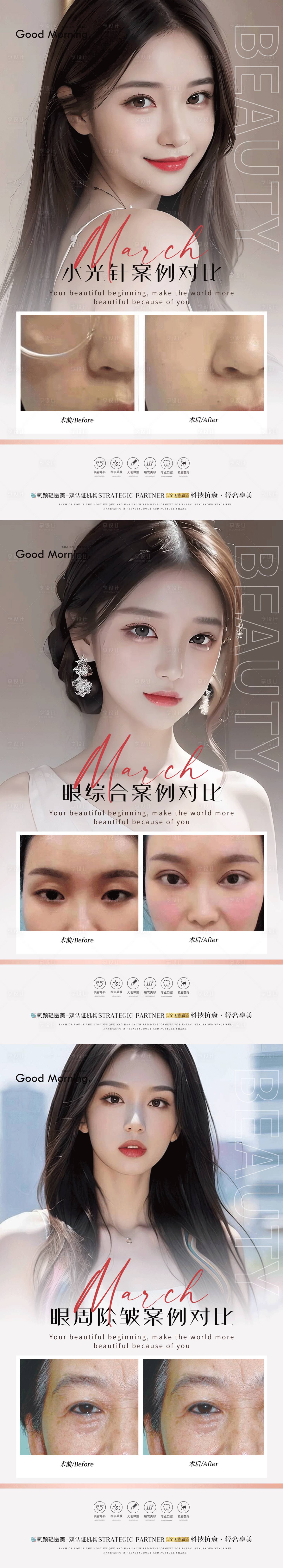 源文件下载【医美案例对比】编号：50640022304216717