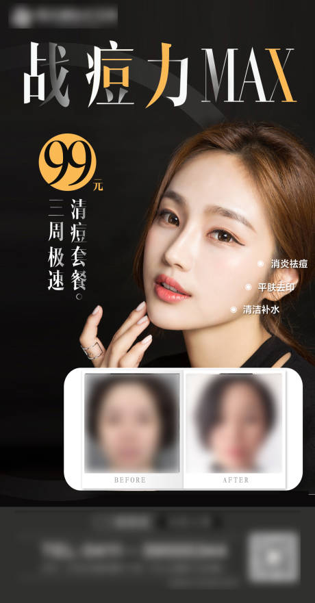 源文件下載【祛痘醫(yī)美海報】編號：25240022914983264