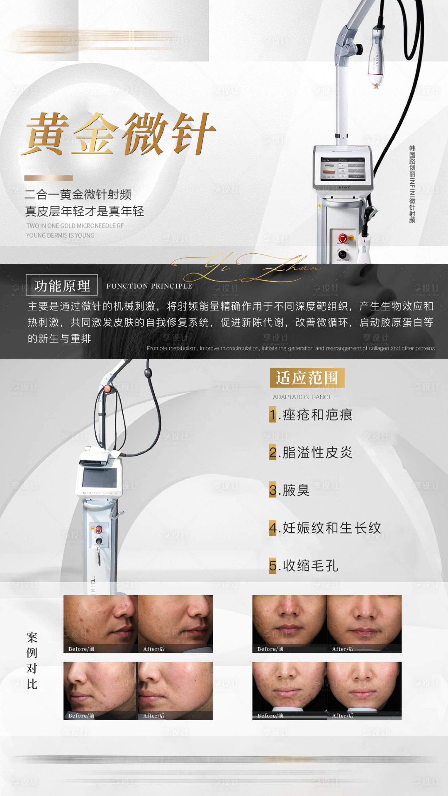 源文件下载【享设计】搜索编号：34600022517378379【黄金微针射频医美仪器科普海报】