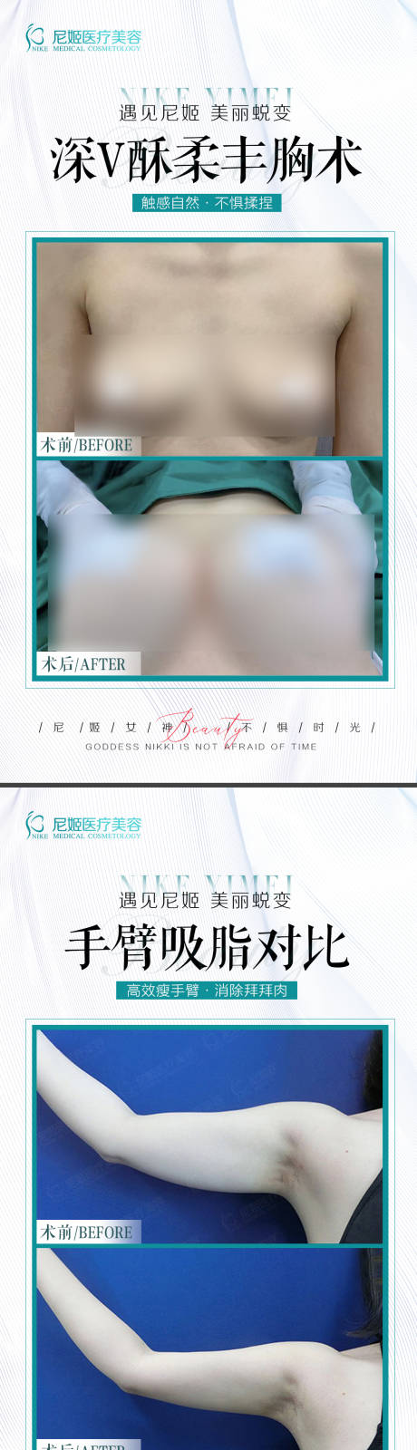 源文件下载【医美对比案例】编号：61120022505564929