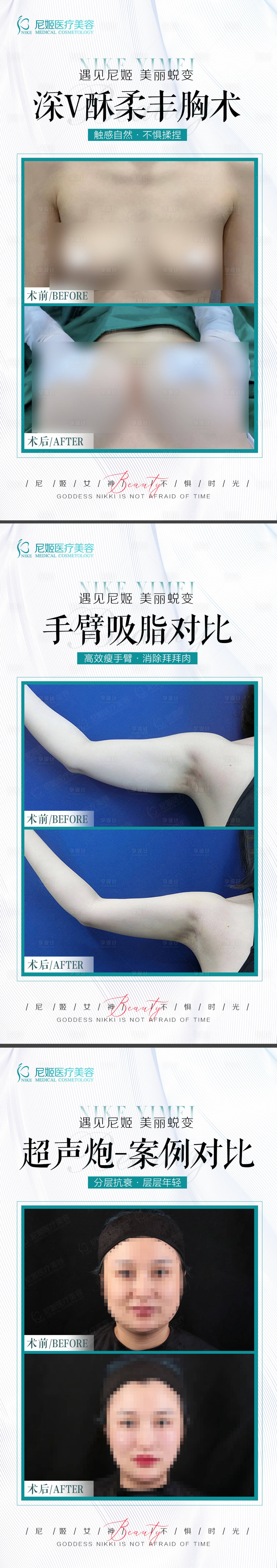 源文件下載【享設(shè)計(jì)】搜索編號(hào)：61120022505564929【醫(yī)美對(duì)比案例】