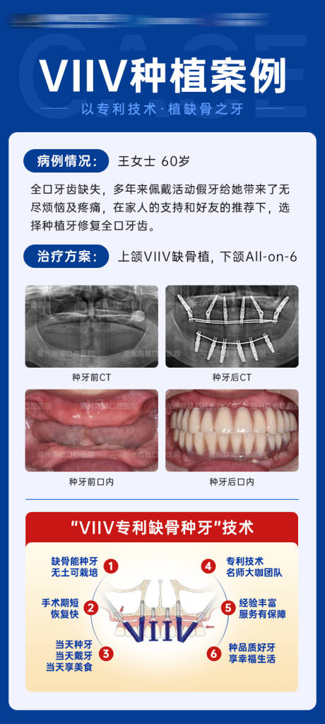 源文件下载【种植牙案例对比海报】编号：85730022841962981