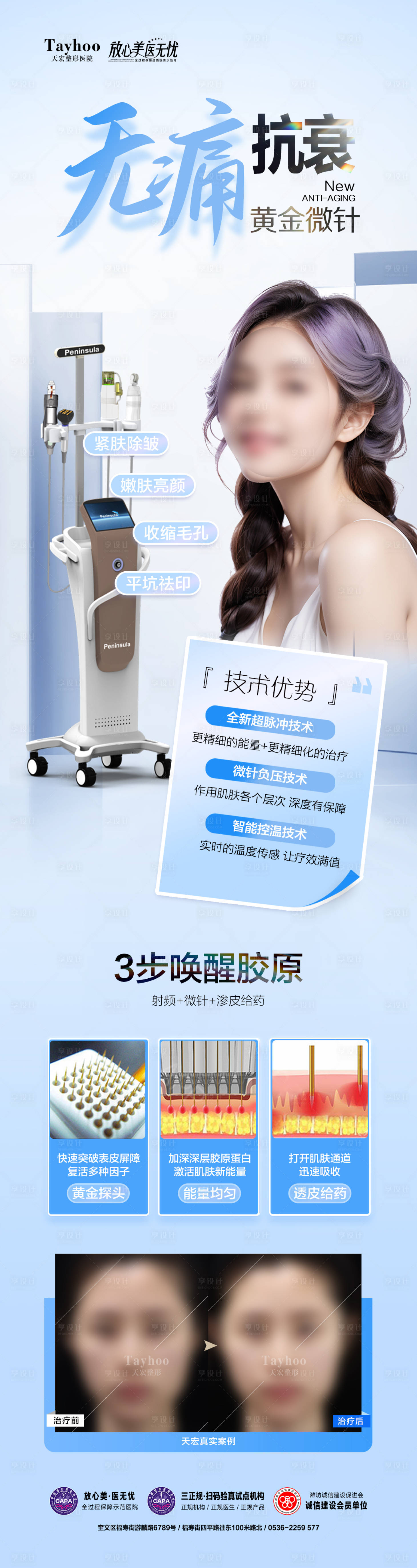 源文件下载【黄金微针】编号：10380022912154037