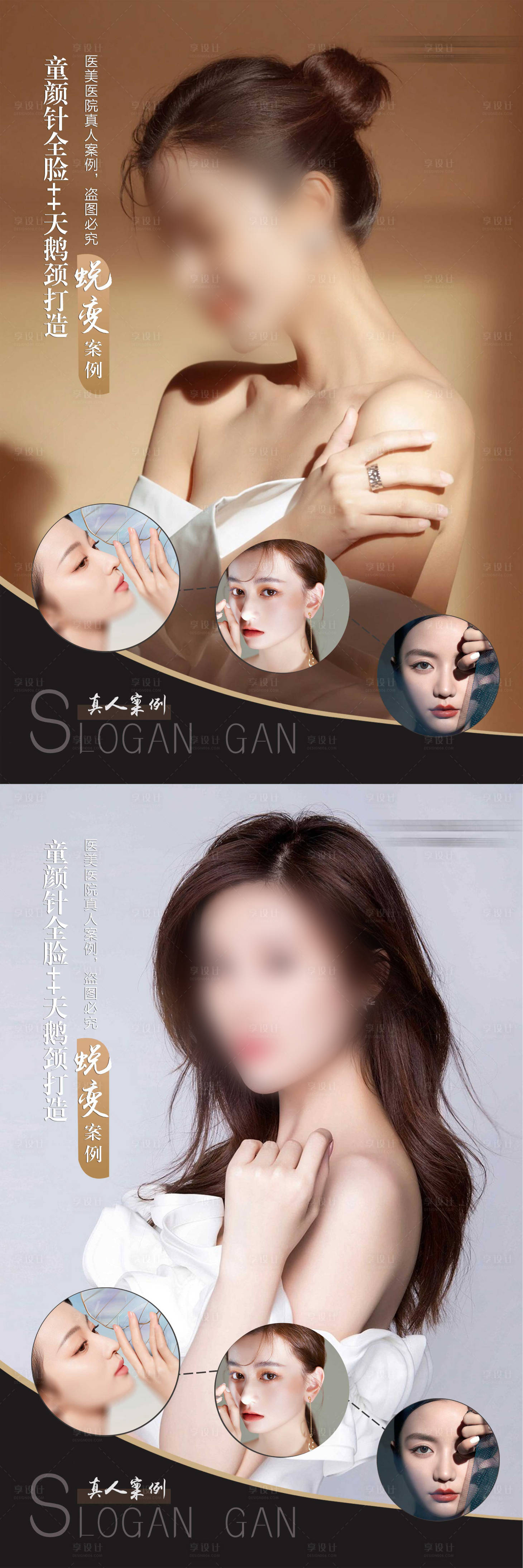 源文件下載【享設計】搜索編號：86010022283639939【醫美案例對比圖設計】