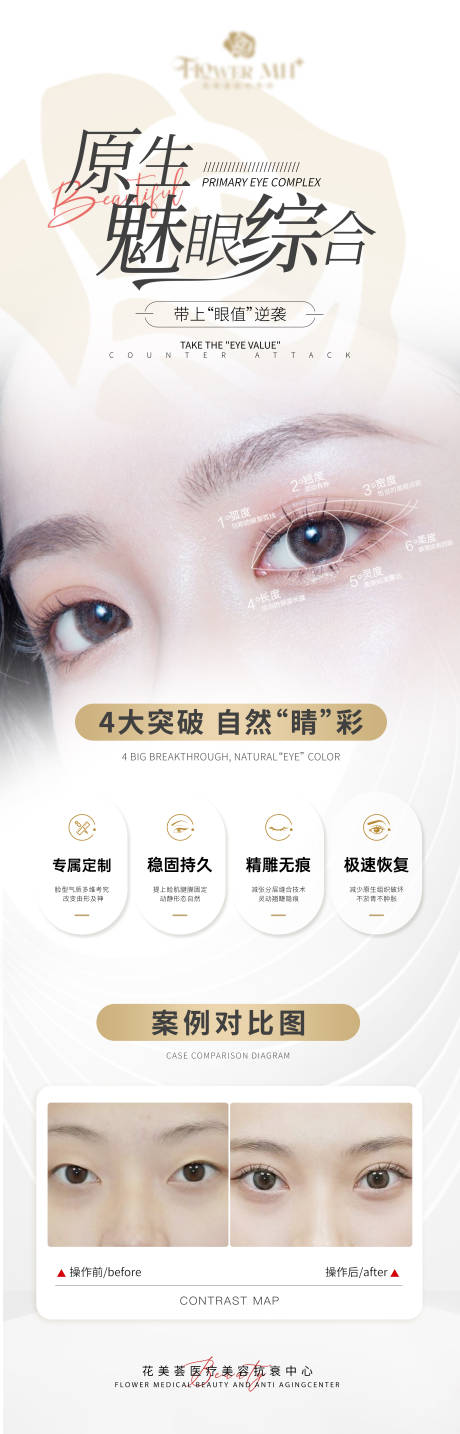 源文件下載【享設計】搜索編號：40280022553134466【眼部案例對比長圖海報】