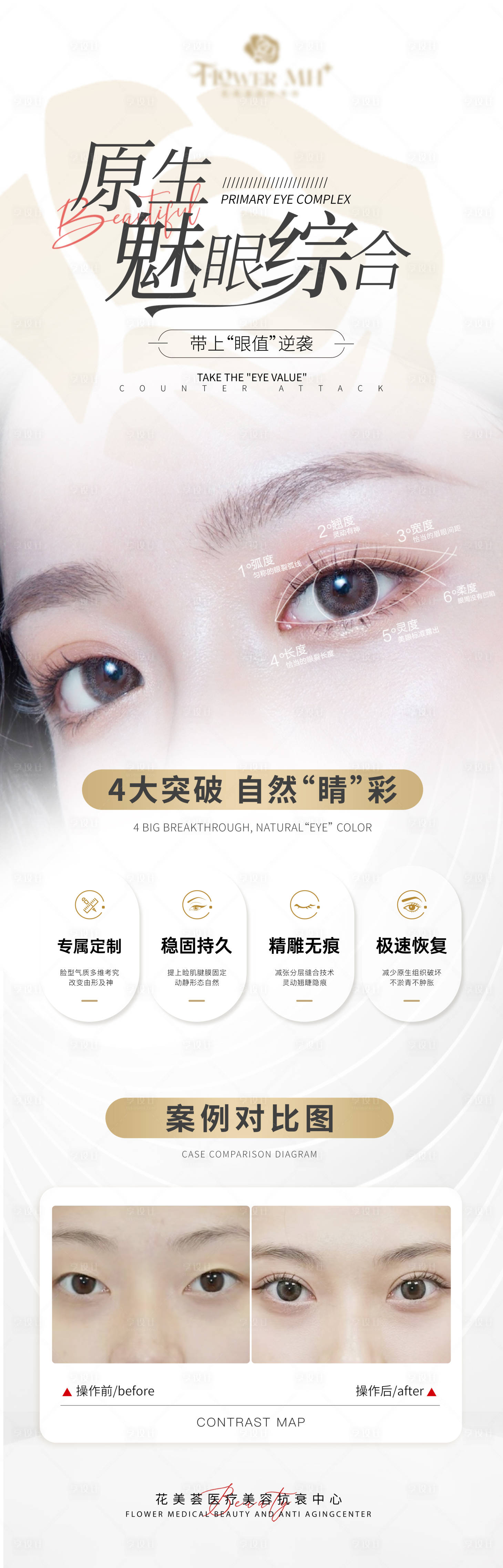 源文件下載【享設(shè)計】搜索編號：40280022553134466【眼部案例對比長圖海報】