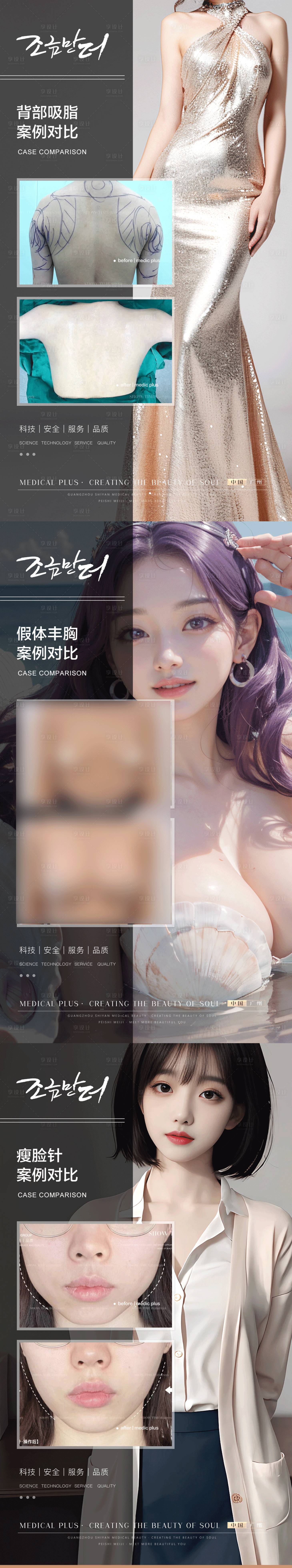 源文件下载【整形案例宣传系列海报】编号：74180022360577278