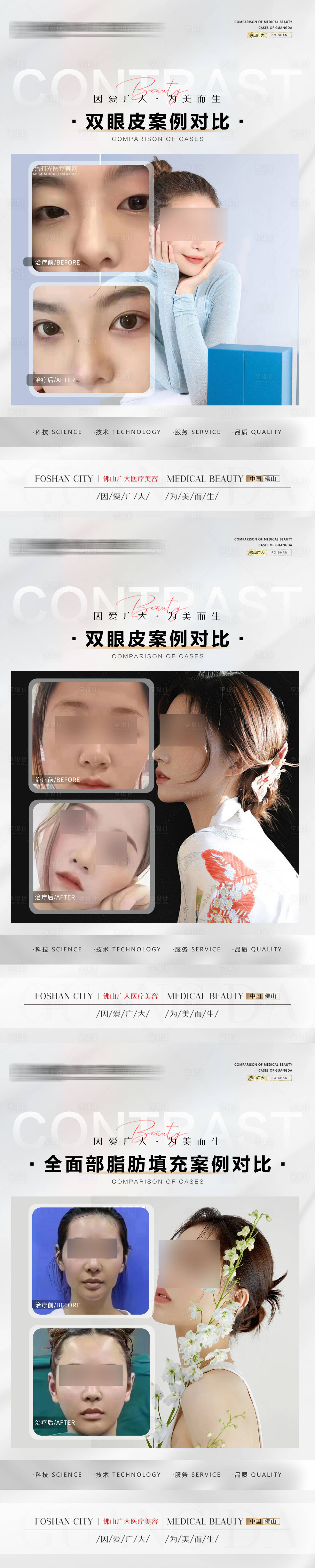 源文件下载【享设计】搜索编号：69990022573274389【整形美容案例海报】