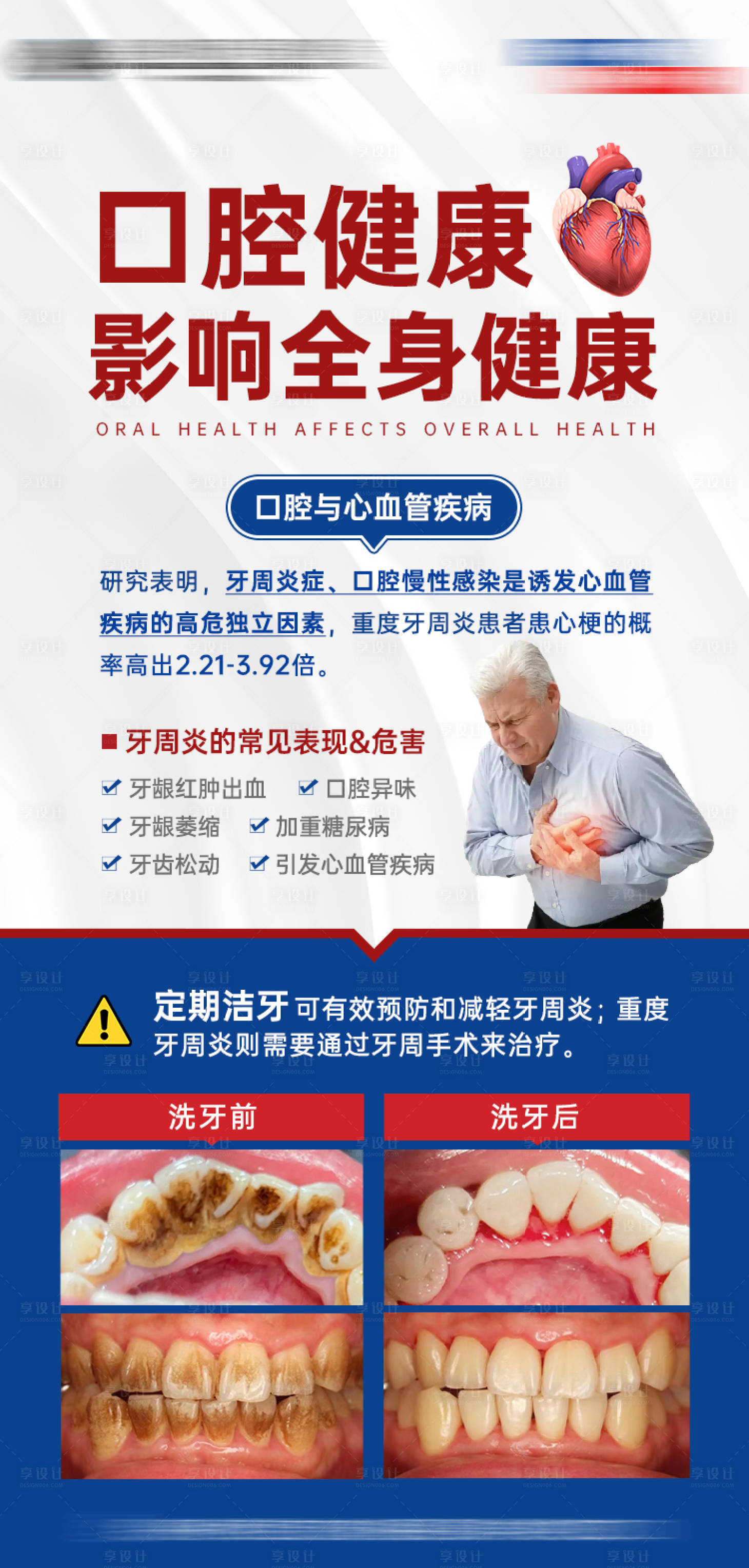 源文件下載【享設(shè)計】搜索編號：91400022787619070【口腔洗牙案例海報】