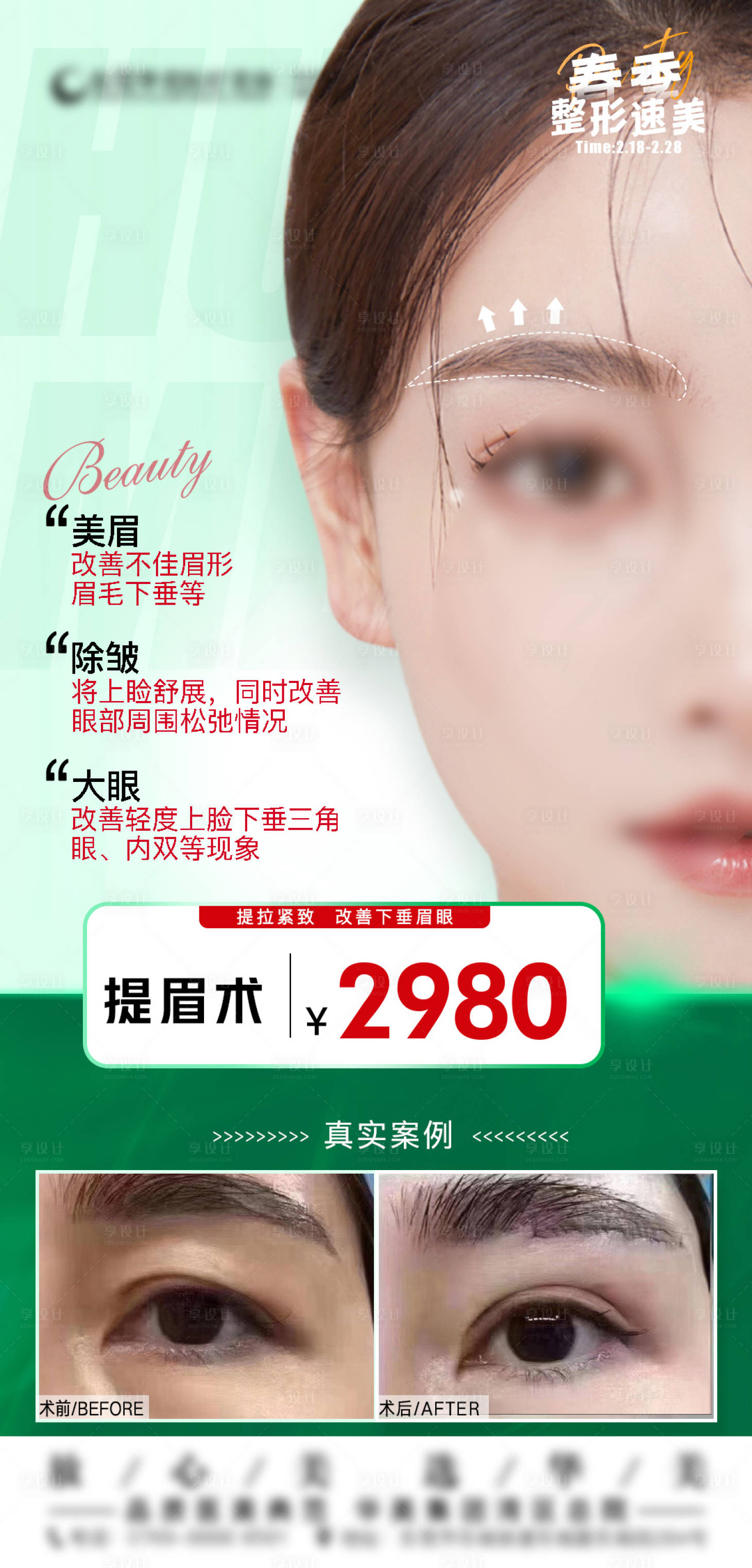 源文件下載【享設計】搜索編號：37000022535581336【醫美提眉海報】