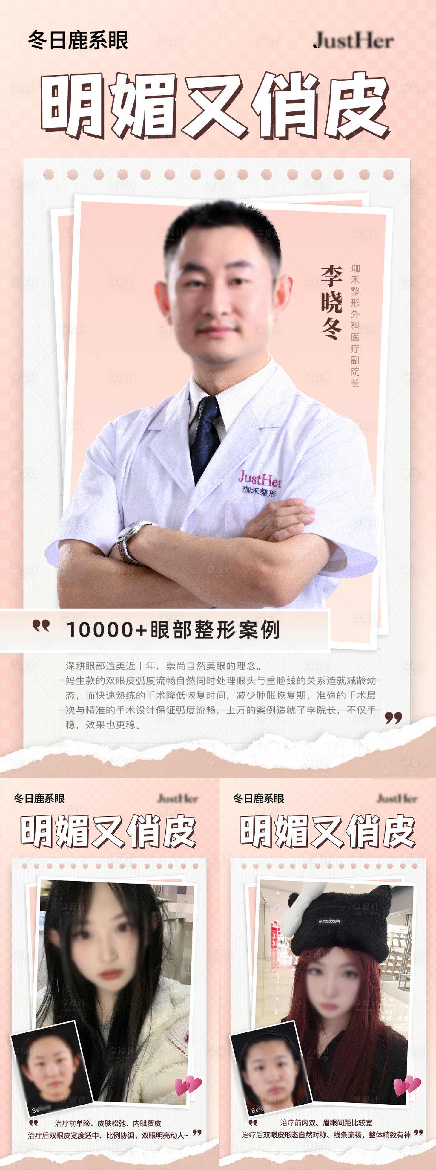 源文件下載【享設(shè)計(jì)】搜索編號(hào)：62330022520622287【雙眼皮案例對(duì)比海報(bào)】