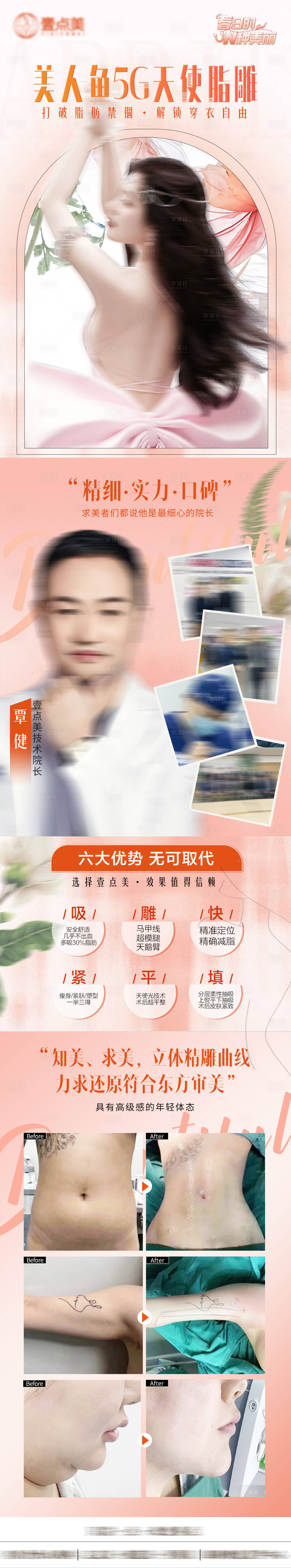 源文件下载【医美吸脂活动长图】编号：10690022415315869